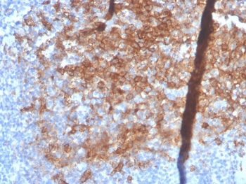 Syndecan-1 Antibody / CD138