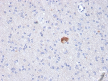 Amyloid beta Antibody / APP