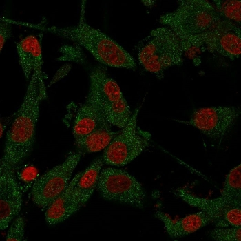 Amyloid beta Antibody / APP