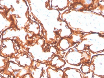 EGF Receptor / EGFR Antibody-L858R Mutant Specific