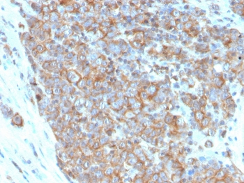 CD33 Antibody