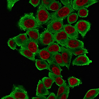 Alpha Actin Antibody / ACTA2 (smooth muscle)
