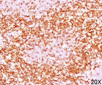 CD6 Antibody