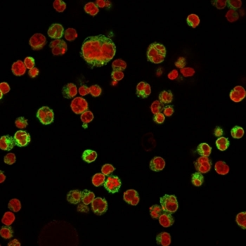 CD74 / CLIP Antibody