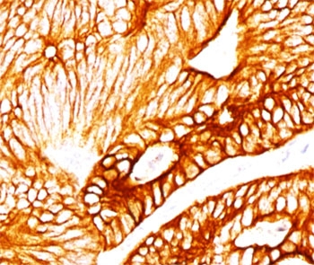 KRT8 Antibody / Cytokeratin 8