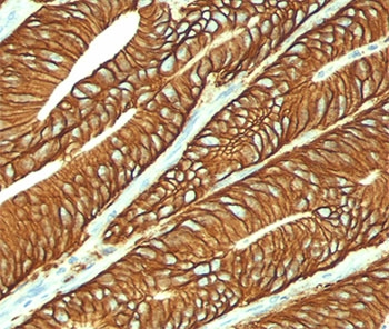 EpCAM Antibody
