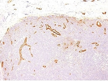 von Willebrand Factor Antibody / vWF
