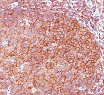 Bcl10 Antibody