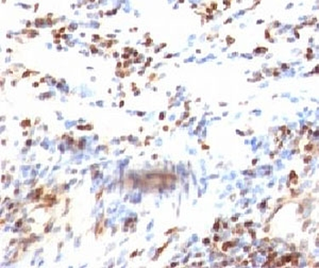 p27 Antibody / p27Kip1