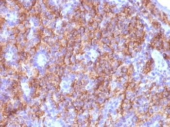 Chromogranin A Antibody Cocktail
