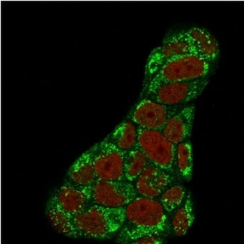 TOP1MT Antibody / Topoisomerase I mitochondrial