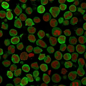 Calponin 1 Antibody