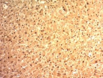 Glypican 3 Antibody / GPC3
