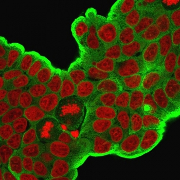 HSP27 Antibody / HSPB1