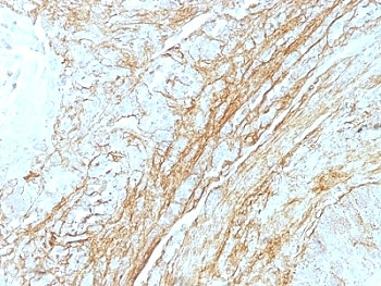 Tenascin C Antibody