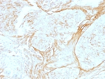 Tenascin C Antibody