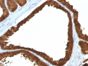 IDH1 Antibody / Isocitrate Dehydrogenase