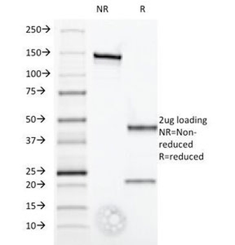 Interferon alpha 1 Antibody / IFNA1