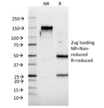 Interferon alpha 2 Antibody / IFNA2