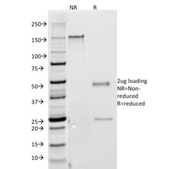 Interferon gamma Antibody / IFNG