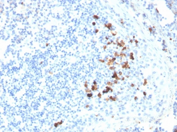 IgA Heavy Chain Antibody
