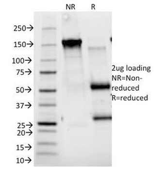 CD25 Antibody / IL2RA