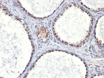 Androgen Receptor Antibody