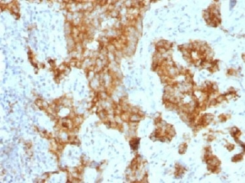 CD11c Antibody / ITGAX