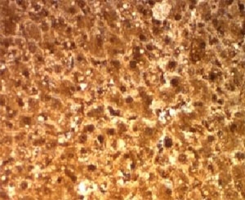 Arginase 1 Antibody