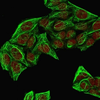 KRT7 Antibody Cocktail / Cytokeratin 7