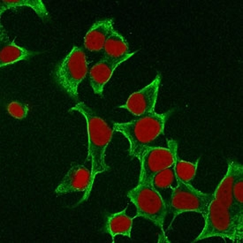 KRT8 Antibody / Cytokeratin 8