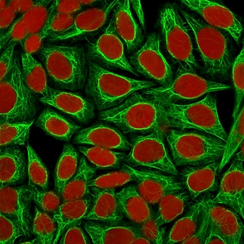 Cytokeratin 18 Antibody