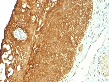KRT19 Antibody / Cytokeratin 19