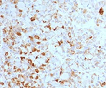 Luteinizing Hormone beta Antibody