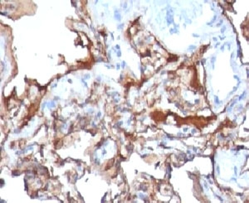 CD146 Antibody / MCAM / MUC18
