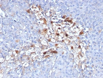 CD146 Antibody / MCAM / MUC18