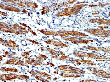 SMMHC Antibody Cocktail (Smooth Muscle Myosin Heavy Chain)