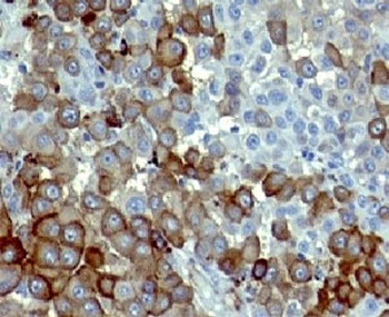 NGF Receptor Antibody / p75NTR / CD271