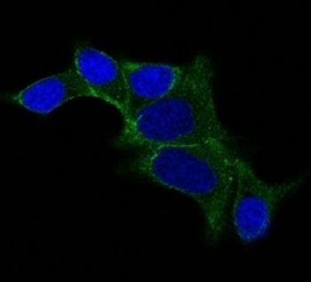 Ornithine Decarboxylase Antibody / ODC1