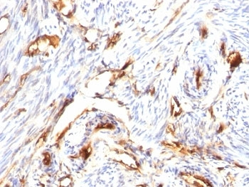 Beta-2 Microglobulin Antibody