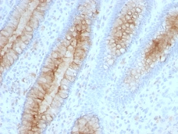 Beta-2 Microglobulin Antibody