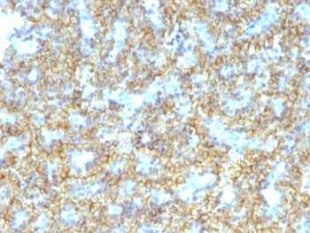Parathyroid Hormone Antibody / C Terminal