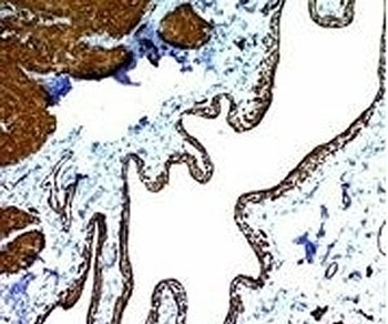 Alpha Actin Antibody / ACTA2 (smooth muscle)