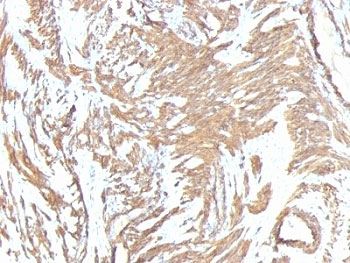 Alpha Actin Antibody Cocktail / ACTA2 (smooth muscle)