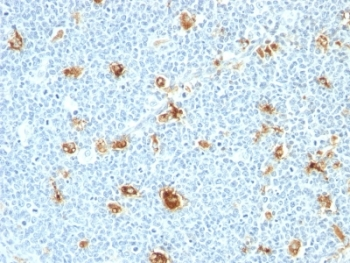 Calgranulin A/B Antibody / S100A8/A9 / Calprotectin