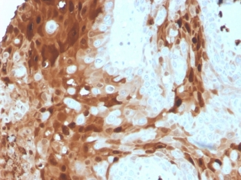 S100A9 Antibody / MRP14 / Calgranulin B / Calprotectin L1H