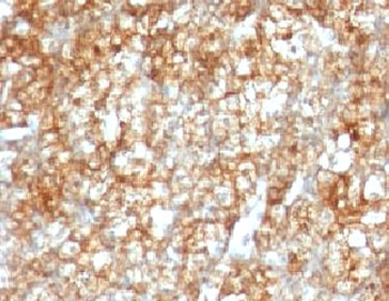 CD147 / Emmprin / Basigin Antibody