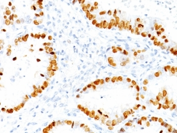 NKX2.1 Antibody / TTF-1