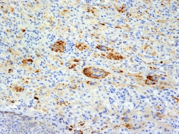 TNF alpha Antibody