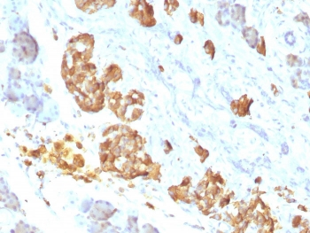 TNF alpha Antibody
